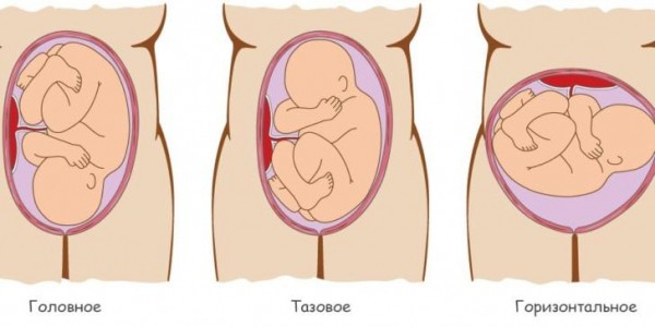 На каком сроке ребенок должен перевернуться вниз головой и виды предлежания