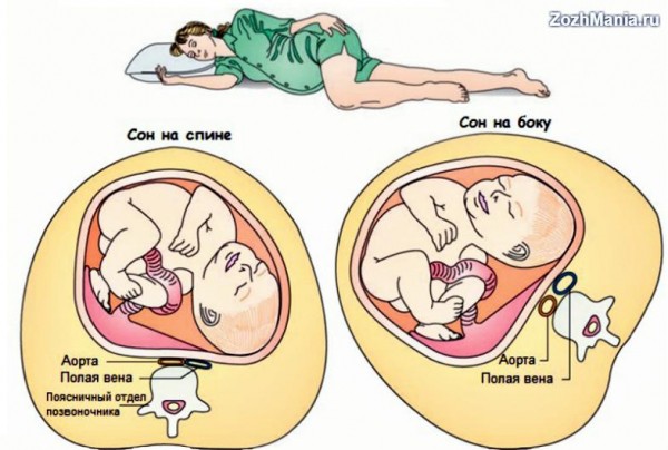 Почему беременным женщинам нельзя спать на спине и правильные позы для отдыха